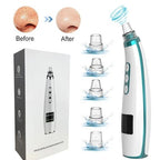 Electric Facial Pore Cleaner & Blackhead Remover